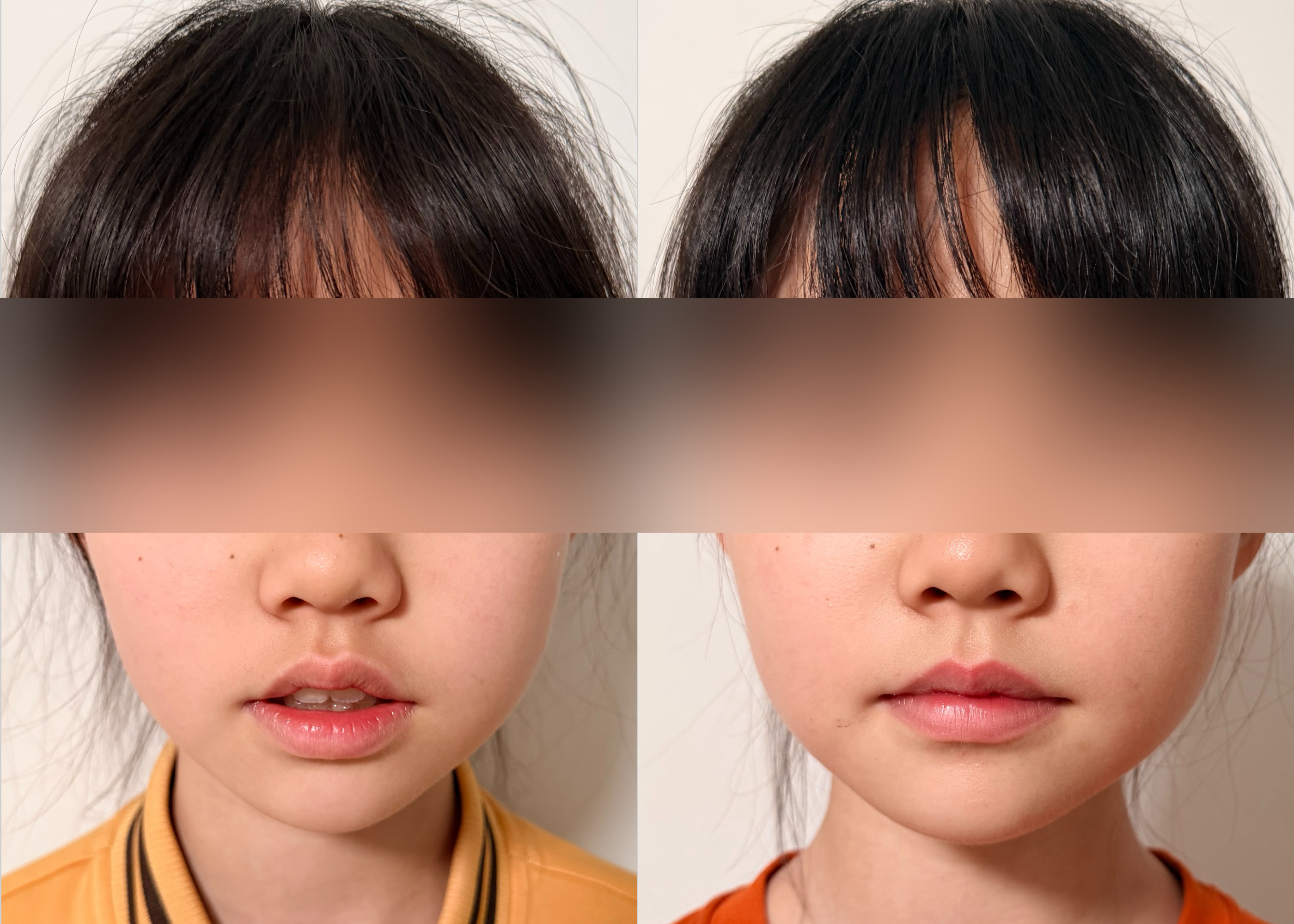 11岁孩子训练前后对比