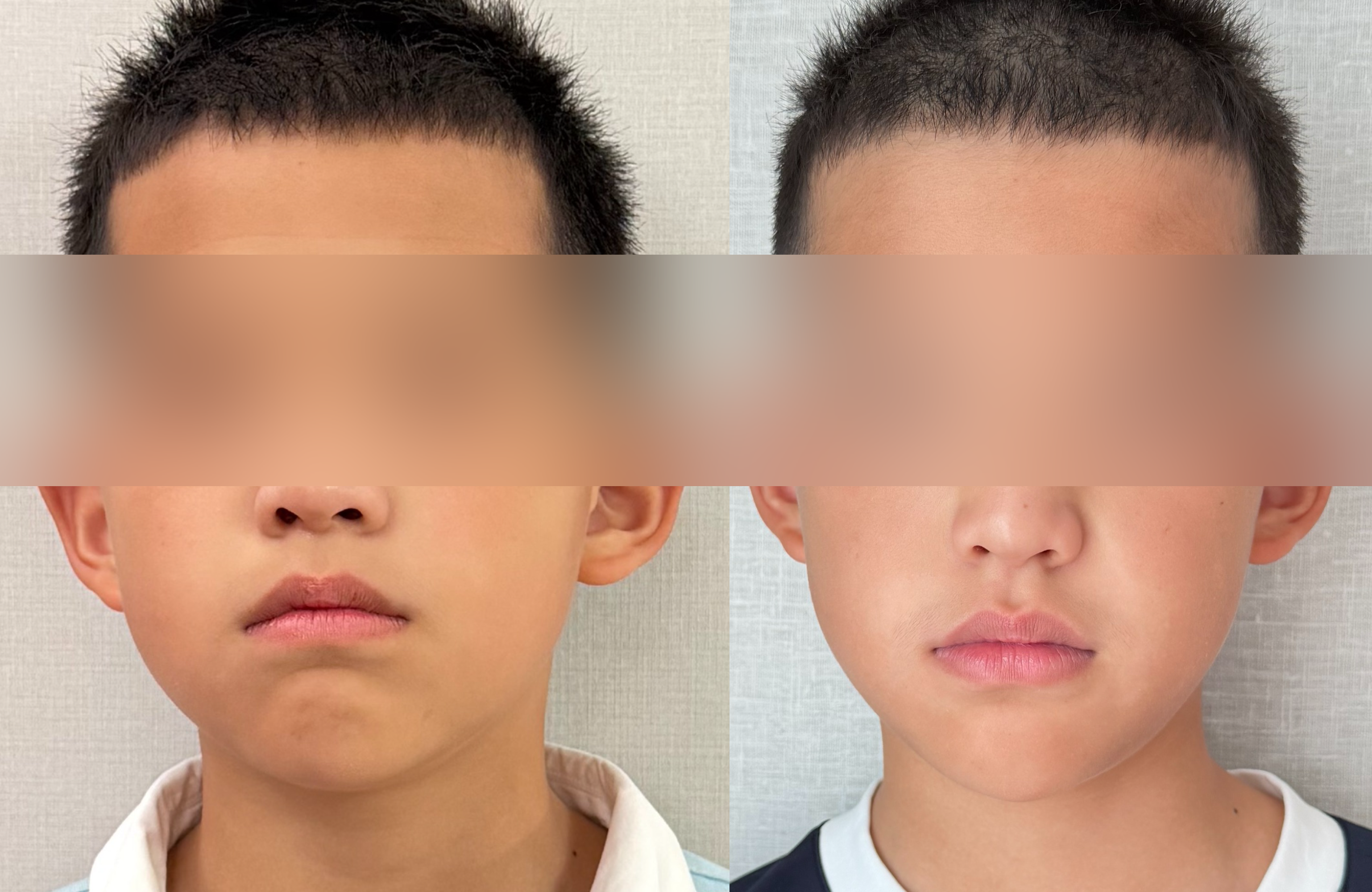 10岁孩子训练前后对比