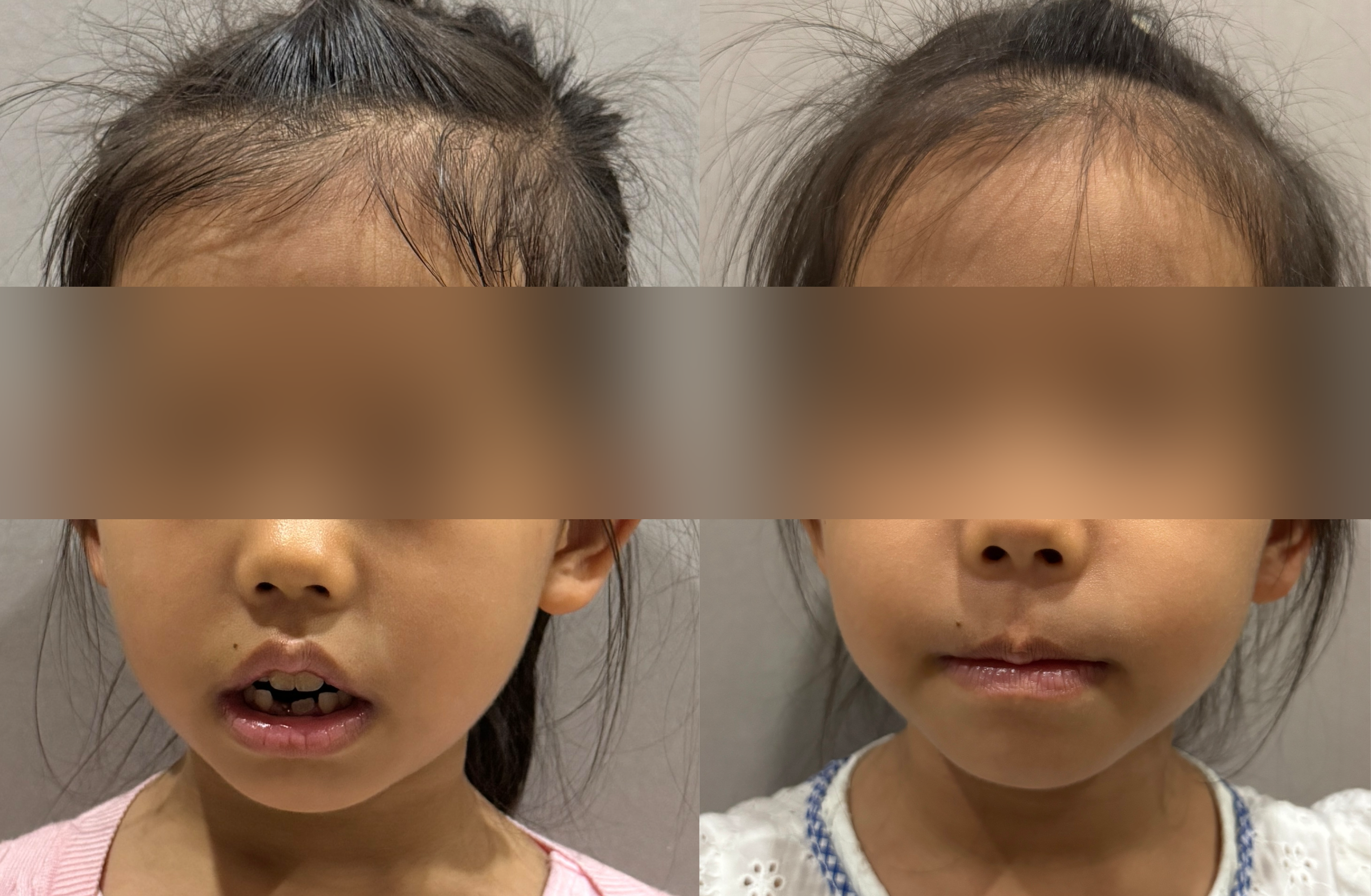5岁孩子训练前后对比