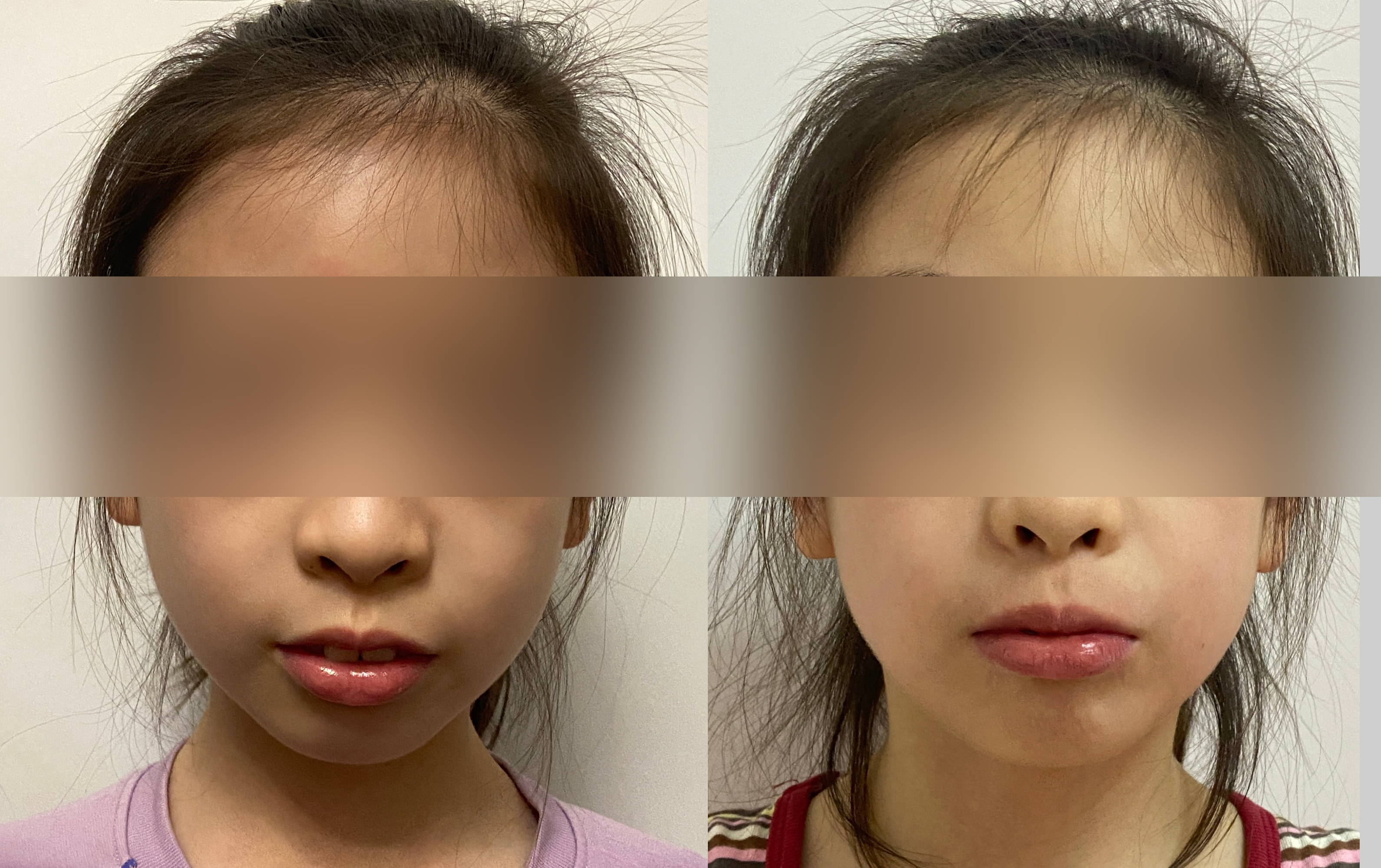 8岁孩子训练前后对比